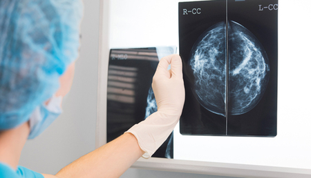 Bild Siloah St. Trudpert Klinikum, Frauenklinik, Arzt hält ein Mammographie-Bild an einen Monitor. 