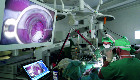Ärztliche Weiterbildung am Siloah St. Trudpert Klinikum, Foto von OP-Saal mit Blick auf Übertragungs-Monitor und Ärzte, die Patient operieren.