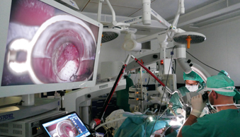 Bild Siloah St. Trudpert Klinikum, HNO, Operationsszenario mit CO2-Laser, 2 Ärzte operieren